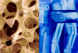 A Comprehensive Guide to Engineering Bone Scaffold Structure Design.