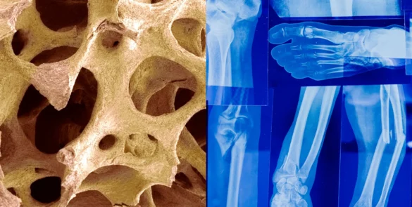 A Comprehensive Guide to Engineering Bone Scaffold Structure Design.